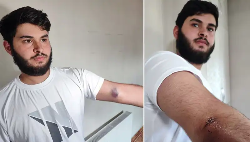 Mahallede Şok: Bahçeye Kaçan Top, Conoları Kamyonetle Getirdi!