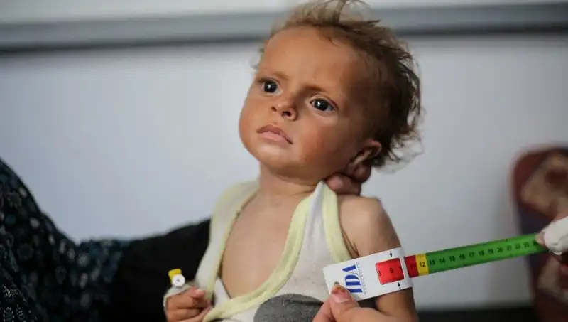 300 Gazzeli Çocuk İçin İngiltere’de Yeni Bir Umut Doğuyor